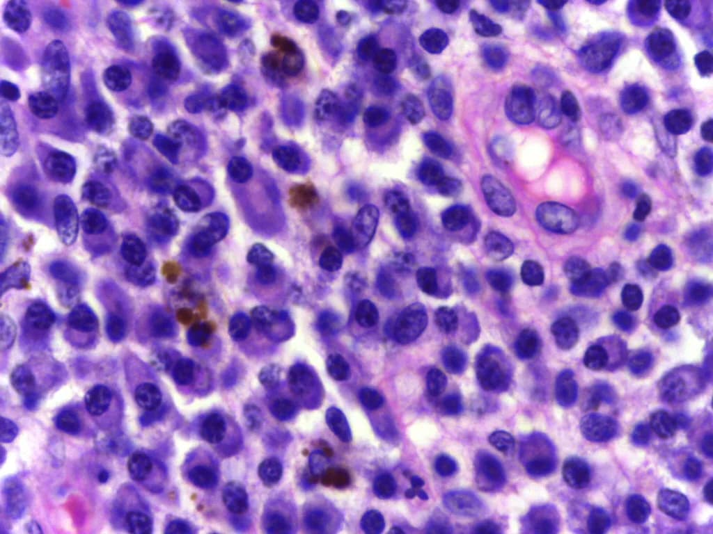 Microscope image of plasma cells with round off-center nuclei