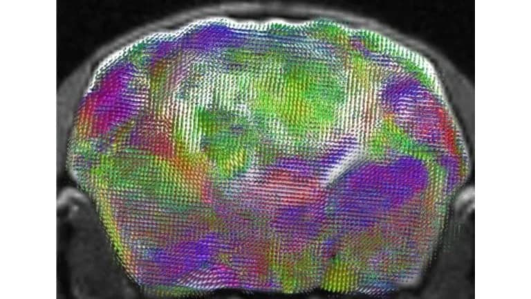 MRI-style brain development imaging from Stanford Medicine Pasca Lab research on a xenocortical mouse model